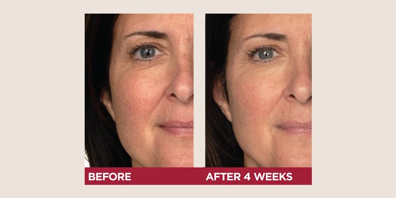 In Article Moisturizer By Skin Type TriplePower 2